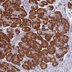 TMEM18 Antibody, Novus Biologicals 0.1mL; Unlabeled:Antibodies, Polyclonal