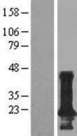 Novus Biologicals&trade;&nbsp;TMEM190 Overexpression Lysate