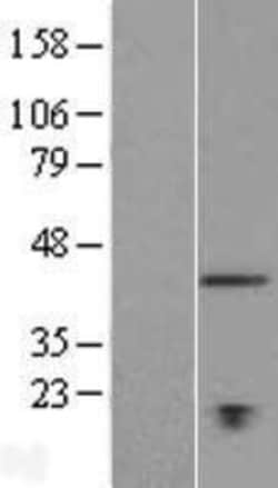 Novus Biologicals&trade;&nbsp;TMEM194A Overexpression Lysate
