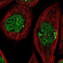 TMEM196 Antibody, Novus Biologicals 25 &mu;L, Unlabeled:Antibodies, Polyclonal