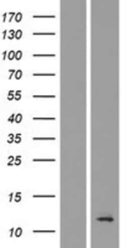 Novus Biologicals&trade;&nbsp;TMEM196 Overexpression Lysate