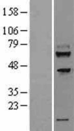 Novus Biologicals&trade;&nbsp;TMEM200A Overexpression Lysate