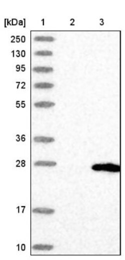 CLP24/TMEM204 Antibody, Novus Biologicals:Antibodies:Primary Antibodies