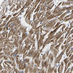 CLP24/TMEM204 Antibody, Novus Biologicals:Antibodies:Primary Antibodies