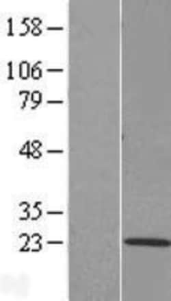 Novus Biologicals&trade;&nbsp;TMEM205 Overexpression Lysate