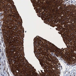 TMEM205 Antibody, Novus Biologicals 0.1mL; Unlabeled:Antibodies, Polyclonal