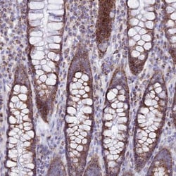 TMEM206 Antibody, Novus Biologicals 0.1mL; Unlabeled:Antibodies, Polyclonal