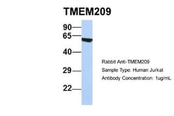 TMEM209 Antibody, Novus Biologicals:Antibodies:Primary Antibodies