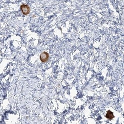TMEM209 Antibody, Novus Biologicals:Antibodies:Primary Antibodies