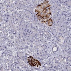 TMEM211 Antibody, Novus Biologicals 0.1mL; Unlabeled:Anticorps, Polyclonal