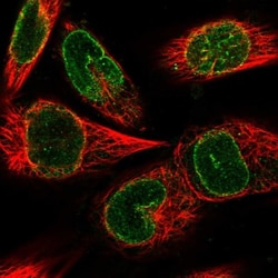 TMEM221 Antibody, Novus Biologicals:Antibodies:Primary Antibodies