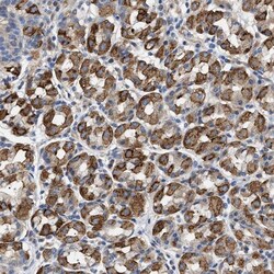 TMEM222 Antibody, Novus Biologicals:Antibodies:Primary Antibodies