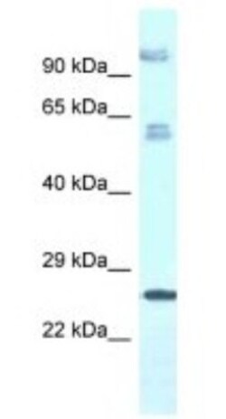 TMEM222 Antibody, Novus Biologicals 100&mu;L; Unlabeled:Antibodies, Polyclonal