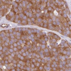 TMEM229A Antibody, Novus Biologicals 0.1mL; Unlabeled:Antibodies, Polyclonal