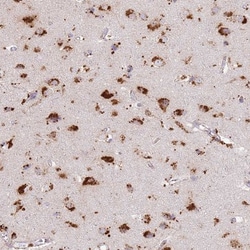 TMEM229B Antibody, Novus Biologicals:Antibodies:Primary Antibodies