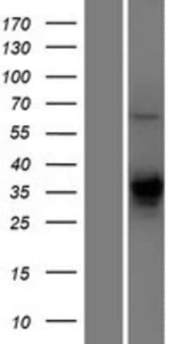 Novus Biologicals&trade;&nbsp;TMEM231 Overexpression Lysate