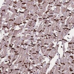 TMEM232 Antibody, Novus Biologicals 0.1mL; Unlabeled:Antibodies, Polyclonal