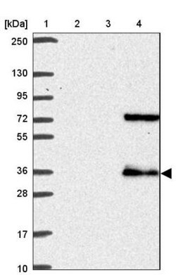 TMEM241 Antibody, Novus Biologicals 25 &mu;L, Unlabeled:Antibodies, Polyclonal