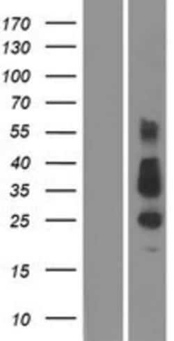 Novus Biologicals&trade;&nbsp;TMEM26 Overexpression Lysate