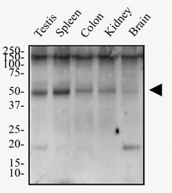 TMEM26 Antibody, Novus Biologicals:Antibodies:Primary Antibodies