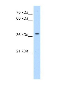 TMEM30A Antibody, Novus Biologicals 100 &mu;L | Buy Online | Novus Biologicals | Fisher Scientific
