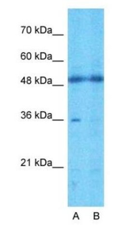 TMEM30A Antibody, Novus Biologicals 100 &mu;L | Buy Online | Novus Biologicals | Fisher Scientific