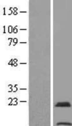 Novus Biologicals&trade;&nbsp;TMEM31 Overexpression Lysate