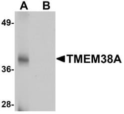 TMEM38A Antibody - BSA Free, Novus Biologicals 0.1mg; Unlabeled:Antibodies,