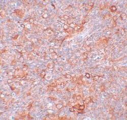 TMEM38B Antibody - BSA Free, Novus Biologicals 0.1mg; Unlabeled:Antibodies,