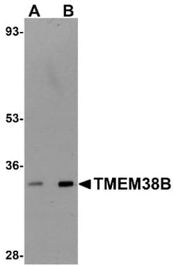 TMEM38B Antibody - BSA Free, Novus Biologicals 0.1mg; Unlabeled:Antibodies,