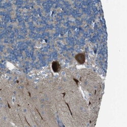 TMEM41B Antibody, Novus Biologicals:Antibodies:Primary Antibodies