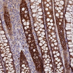TMEM44 Antibody, Novus Biologicals 25 &mu;L | Buy Online | Novus Biologicals | Fisher Scientific