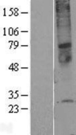 Novus Biologicals™ TMEM45A Overexpression Lysate