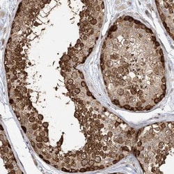 TMEM49 Antibody, Novus Biologicals:Antibodies:Primary Antibodies