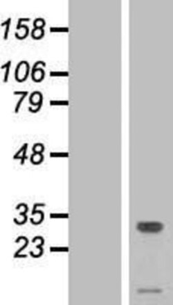 Novus Biologicals&trade;&nbsp;TMEM50A Overexpression Lysate
