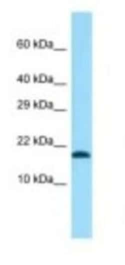 TMEM50B Antibody, Novus Biologicals 100 &mu;L | Buy Online | Novus Biologicals | Fisher Scientific