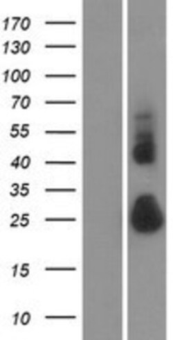 Novus Biologicals&trade;&nbsp;TMEM52 Overexpression Lysate