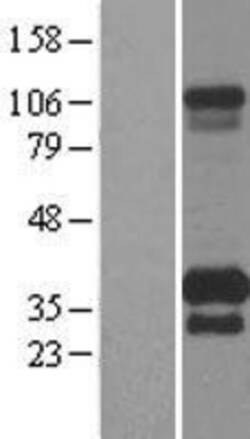 Novus Biologicals&trade;&nbsp;TMEM55B Overexpression Lysate