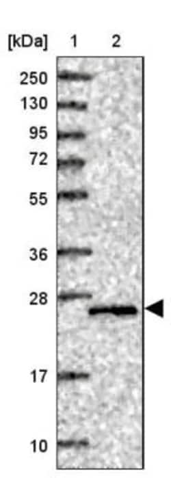 TMEM55B Antibody, Novus Biologicals 25 &mu;L, Unlabeled:Antibodies, Polyclonal