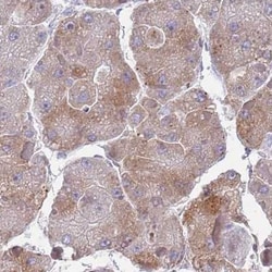 TMEM56 Antibody, Novus Biologicals 25 &mu;L, Unlabeled:Antibodies, Polyclonal