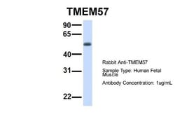 TMEM57 Antibody, Novus Biologicals 100 &mu;L | Buy Online | Novus Biologicals | Fisher Scientific