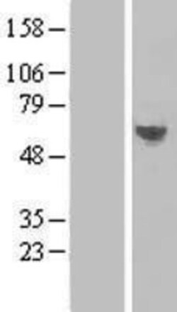 Novus Biologicals™ TMEM57 Overexpression Lysate