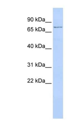 TMEM57 Antibody, Novus Biologicals 100 &mu;L | Buy Online | Novus Biologicals | Fisher Scientific