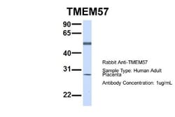 TMEM57 Antibody, Novus Biologicals 100 &mu;L | Buy Online | Novus Biologicals | Fisher Scientific