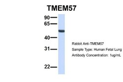 TMEM57 Antibody, Novus Biologicals 100 &mu;L | Buy Online | Novus Biologicals | Fisher Scientific