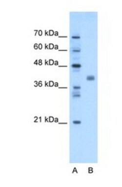 TMEM59L Antibody, Novus Biologicals 100 &mu;L | Buy Online | Novus Biologicals | Fisher Scientific