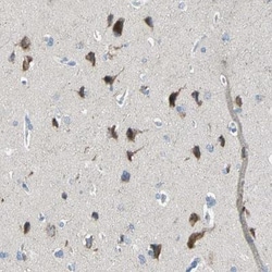 TMEM59L Antibody, Novus Biologicals:Antibodies:Primary Antibodies