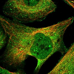 TMEM61 Antibody, Novus Biologicals 25 &mu;L | Buy Online | Novus Biologicals | Fisher Scientific