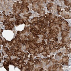 TMEM61 Antibody, Novus Biologicals 25 &mu;L | Buy Online | Novus Biologicals | Fisher Scientific