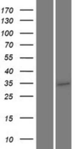Novus Biologicals&trade;&nbsp;TMEM64 Overexpression Lysate